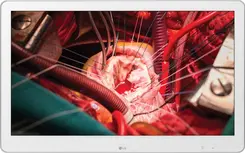 LG Medical 27HK510S-W, 27"